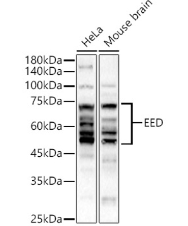 EED Rabbit Polyclonal Antibody