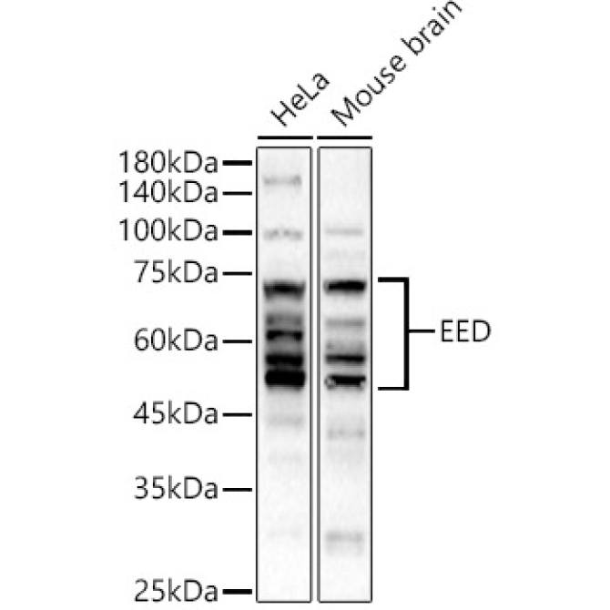EED Rabbit Polyclonal Antibody