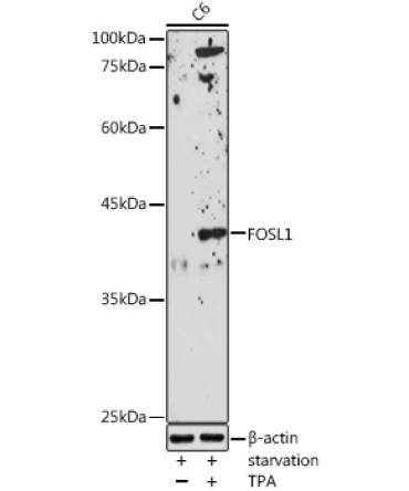 FOSL1 Rabbit Polyclonal Antibody
