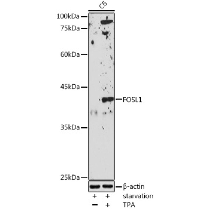 FOSL1 Rabbit Polyclonal Antibody