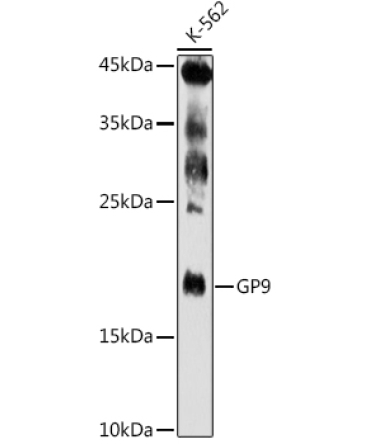GP9 Rabbit Polyclonal Antibody