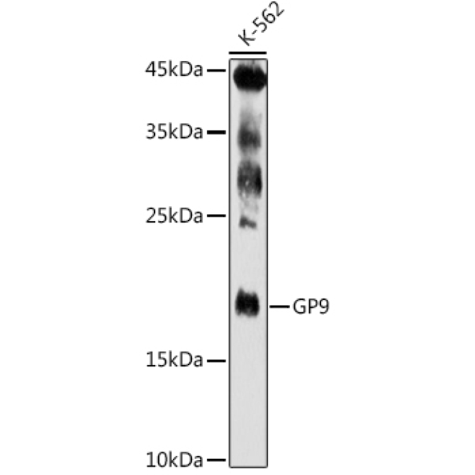 GP9 Rabbit Polyclonal Antibody