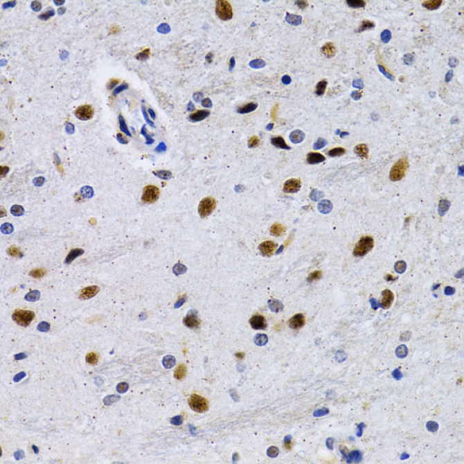 ID3 Rabbit Polyclonal Antibody