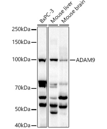 ADAM9 Rabbit Polyclonal Antibody