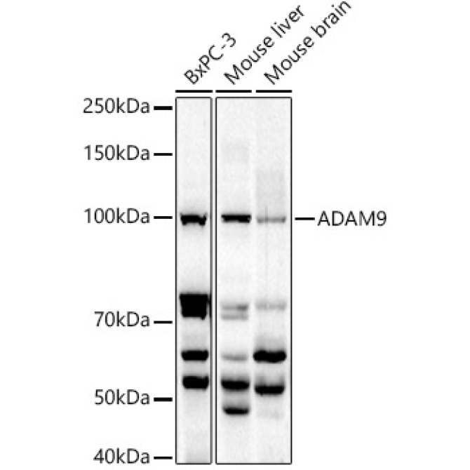 ADAM9 Rabbit Polyclonal Antibody
