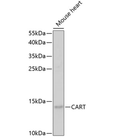 CART Rabbit Polyclonal Antibody