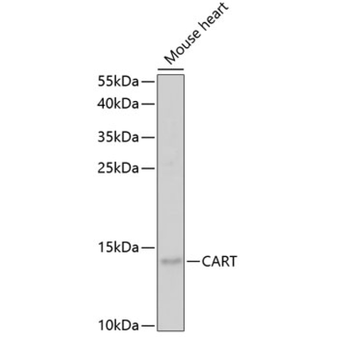CART Rabbit Polyclonal Antibody