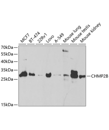 CHMP2B Rabbit Polyclonal Antibody