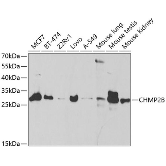 CHMP2B Rabbit Polyclonal Antibody