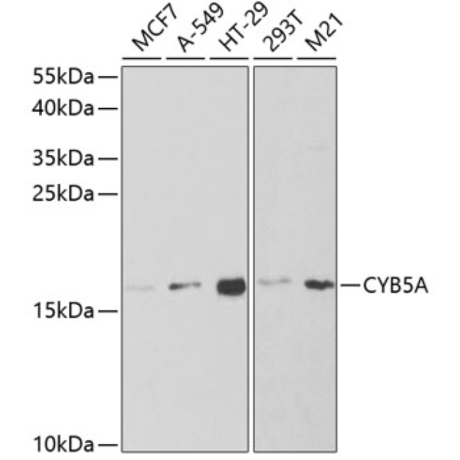 CYB5A Rabbit Polyclonal Antibody