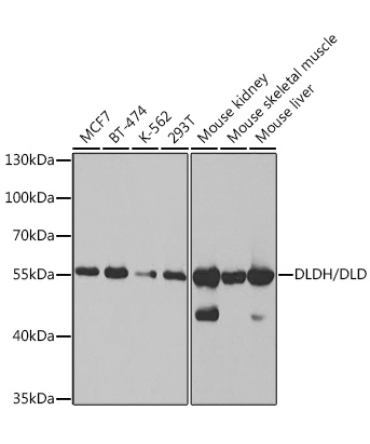 DLDH/DLD Rabbit Polyclonal Antibody