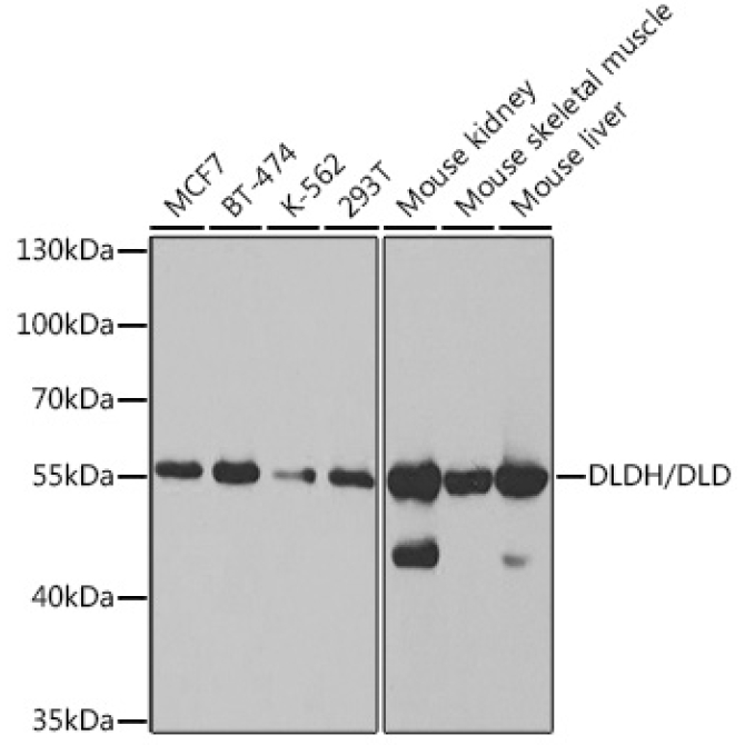 DLDH/DLD Rabbit Polyclonal Antibody