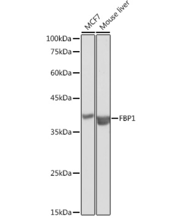 FBP1 Rabbit Polyclonal Antibody