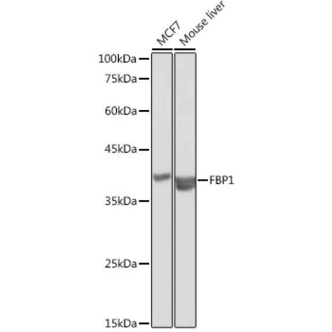 FBP1 Rabbit Polyclonal Antibody
