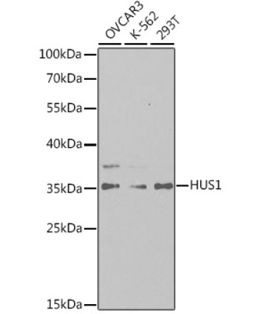 HUS1 Rabbit Polyclonal Antibody
