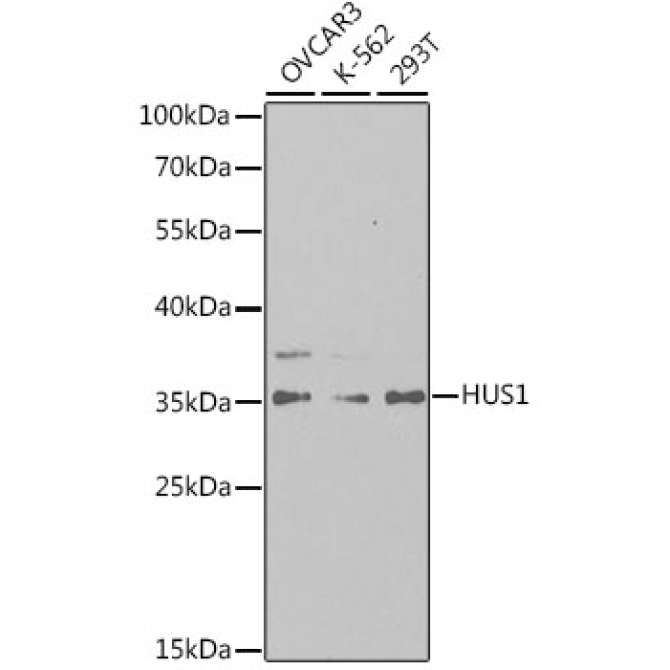 HUS1 Rabbit Polyclonal Antibody
