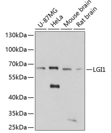 LGI1 Rabbit Polyclonal Antibody