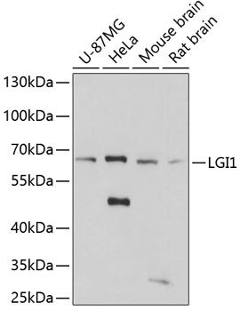 LGI1 Rabbit Polyclonal Antibody