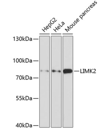 LIMK2 Rabbit Polyclonal Antibody