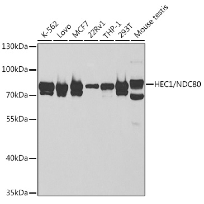 HEC1/NDC80 Rabbit Polyclonal Antibody