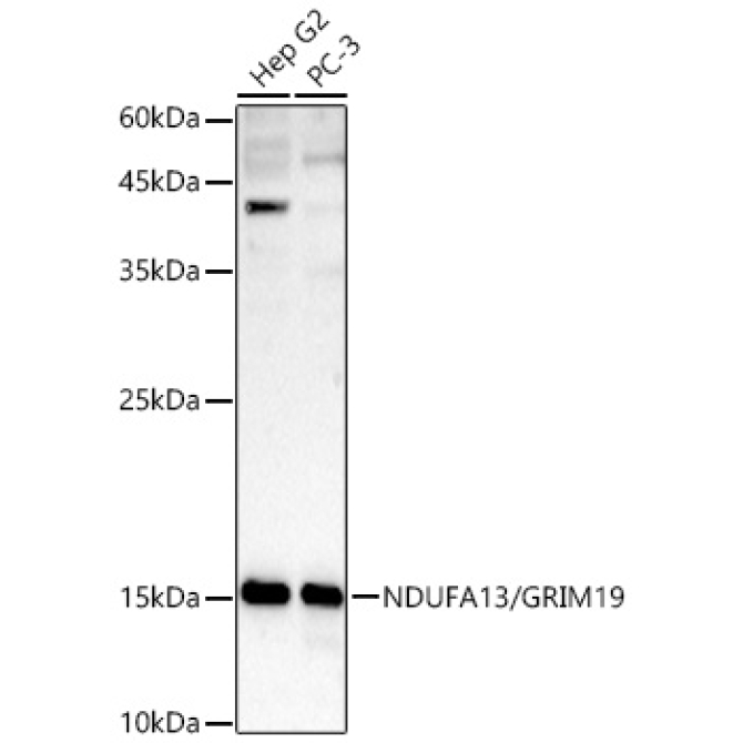 NDUFA13/GRIM19 Rabbit Polyclonal Antibody [KD Validated]