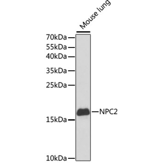 NPC2 Rabbit Polyclonal Antibody