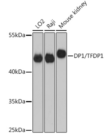 DP1/TFDP1 Rabbit Polyclonal Antibody