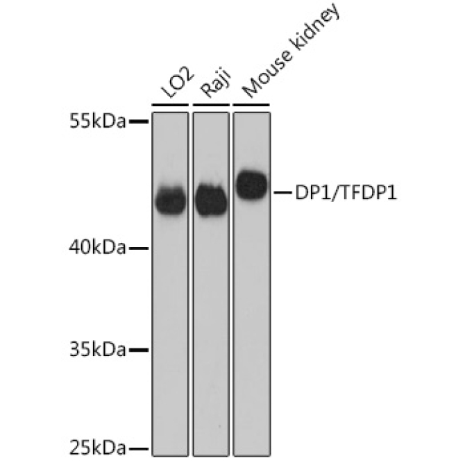 DP1/TFDP1 Rabbit Polyclonal Antibody