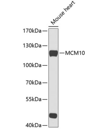 MCM10 Rabbit Polyclonal Antibody