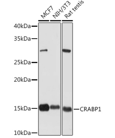 CRABP1 Rabbit Monoclonal Antibody