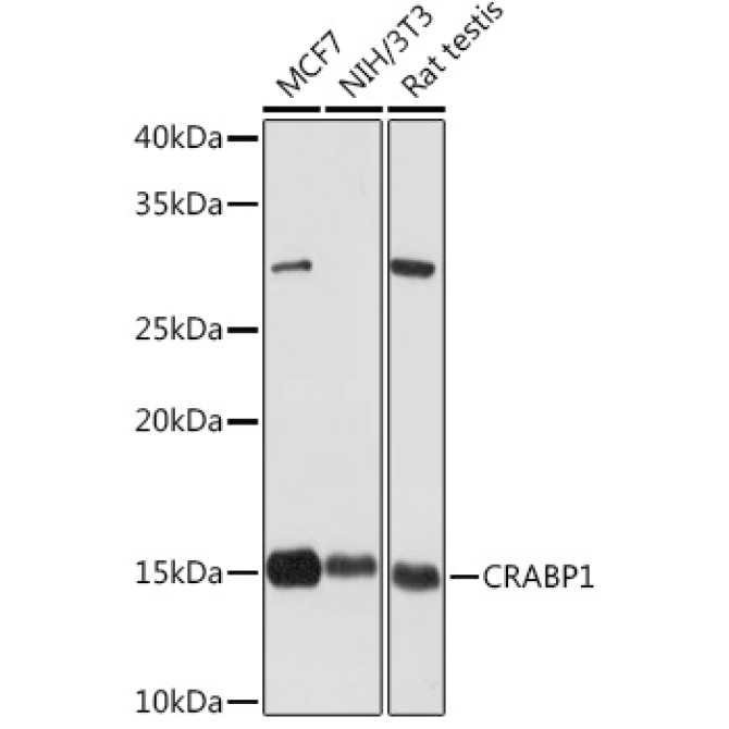 CRABP1 Rabbit Monoclonal Antibody