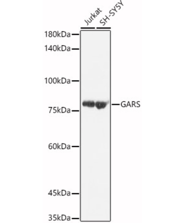 GARS Rabbit Polyclonal Antibody [KO Validated]