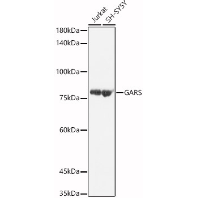 GARS Rabbit Polyclonal Antibody [KO Validated]