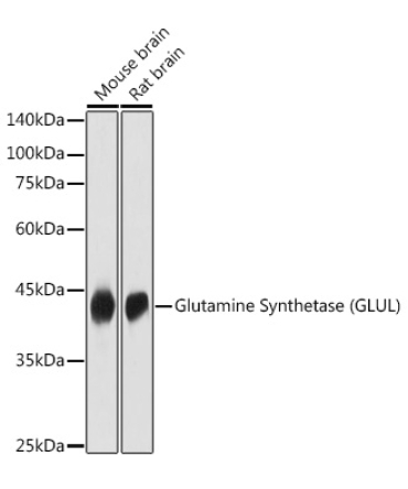 Glutamine Synthetase (GLUL) Rabbit Polyclonal Antibody