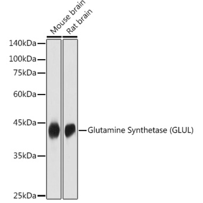 Glutamine Synthetase (GLUL) Rabbit Polyclonal Antibody
