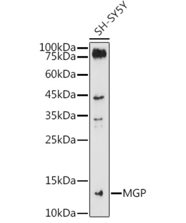 MGP Rabbit Polyclonal Antibody