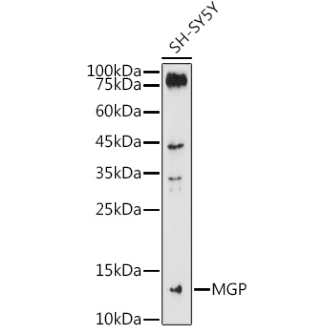MGP Rabbit Polyclonal Antibody