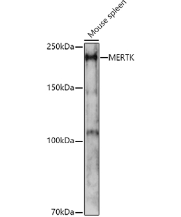MERTK Rabbit Polyclonal Antibody