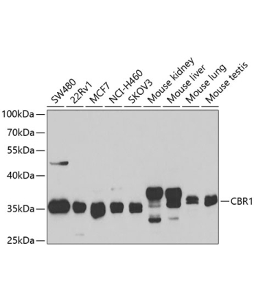 CBR1 Rabbit Polyclonal Antibody