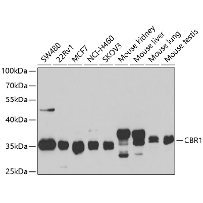 CBR1 Rabbit Polyclonal Antibody