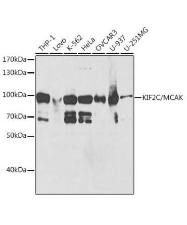 KIF2C/MCAK Rabbit Polyclonal Antibody