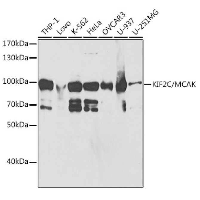 KIF2C/MCAK Rabbit Polyclonal Antibody