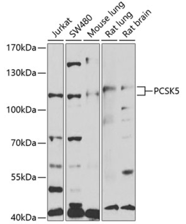 PCSK5 Rabbit Polyclonal Antibody