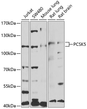 PCSK5 Rabbit Polyclonal Antibody