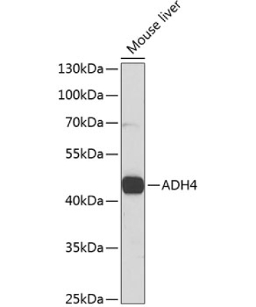 ADH4 Rabbit Polyclonal Antibody