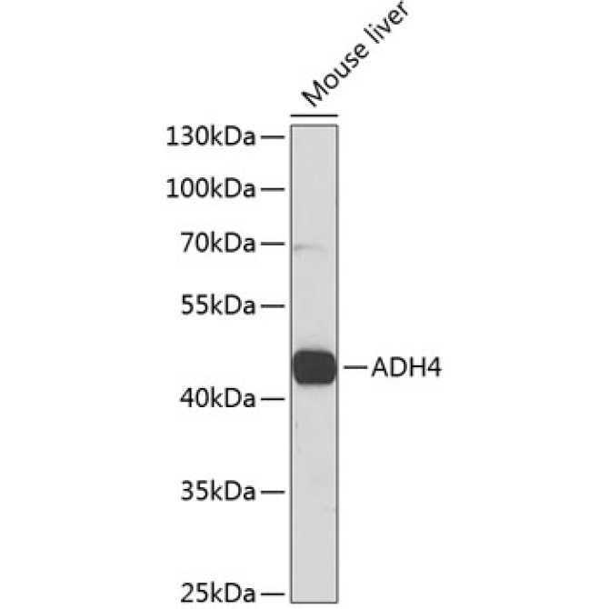 ADH4 Rabbit Polyclonal Antibody