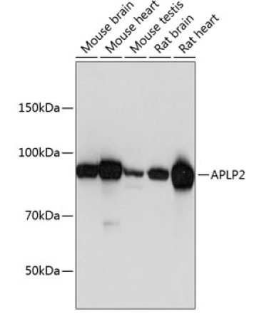 APLP2 Rabbit Polyclonal Antibody