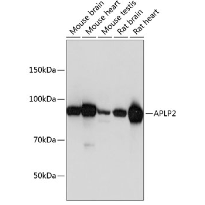 APLP2 Rabbit Polyclonal Antibody