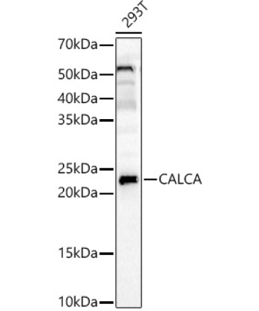 APRT Rabbit Polyclonal Antibody