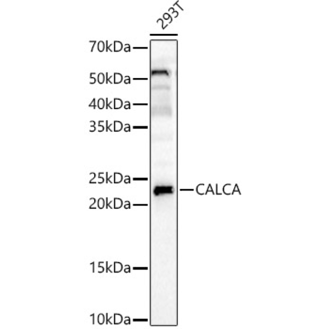 APRT Rabbit Polyclonal Antibody